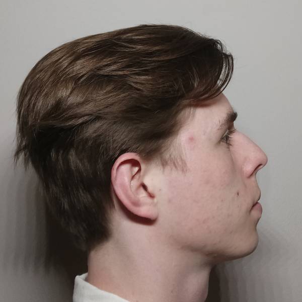 fotografia p013 profilu 0101RMO1YA