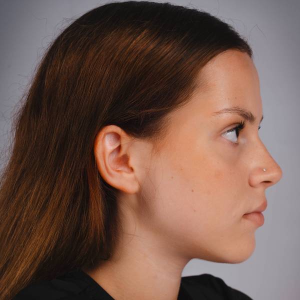 fotografia p014 profilu 010211ZTEY