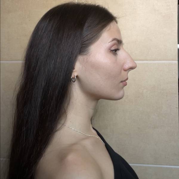 modelka s ID 0401FC2VAY p019