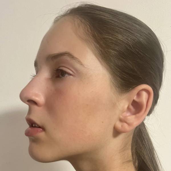 modelka s ID 040290B5KQ p019