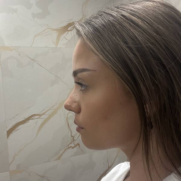 modelka s ID 0402A77ME4 p019