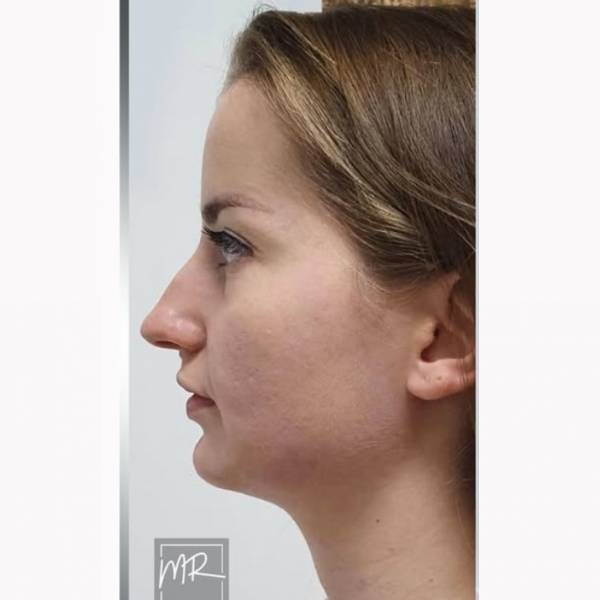 modelka s ID 0402KK7IVJ p019