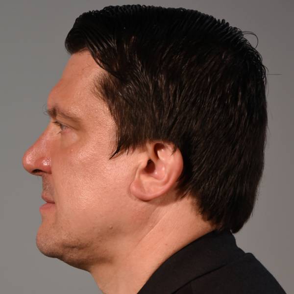 modelka s ID 07015O4CFN p019